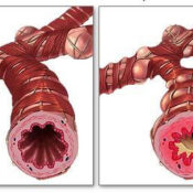 dpoc-fisioterapia-avancada-porto dpoc-fisioterapia-avancada-porto